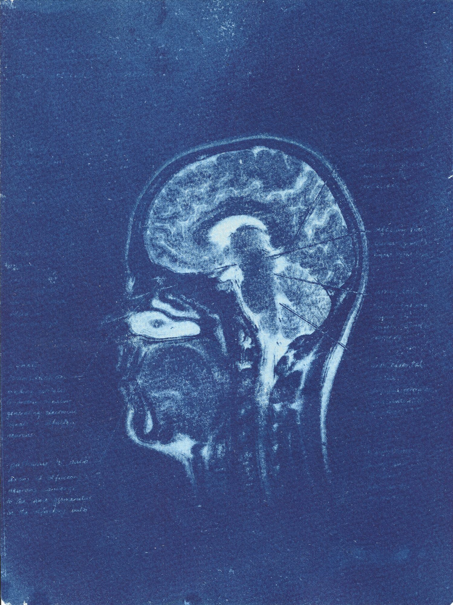 Olfactory Pathway I, cyanotype print, flatbed scan